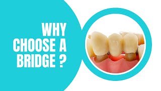 Why choose a bridge? Tooth replacement options explained