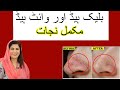 Get rid of black white heads at home  remedy by dr bilquis shaikh