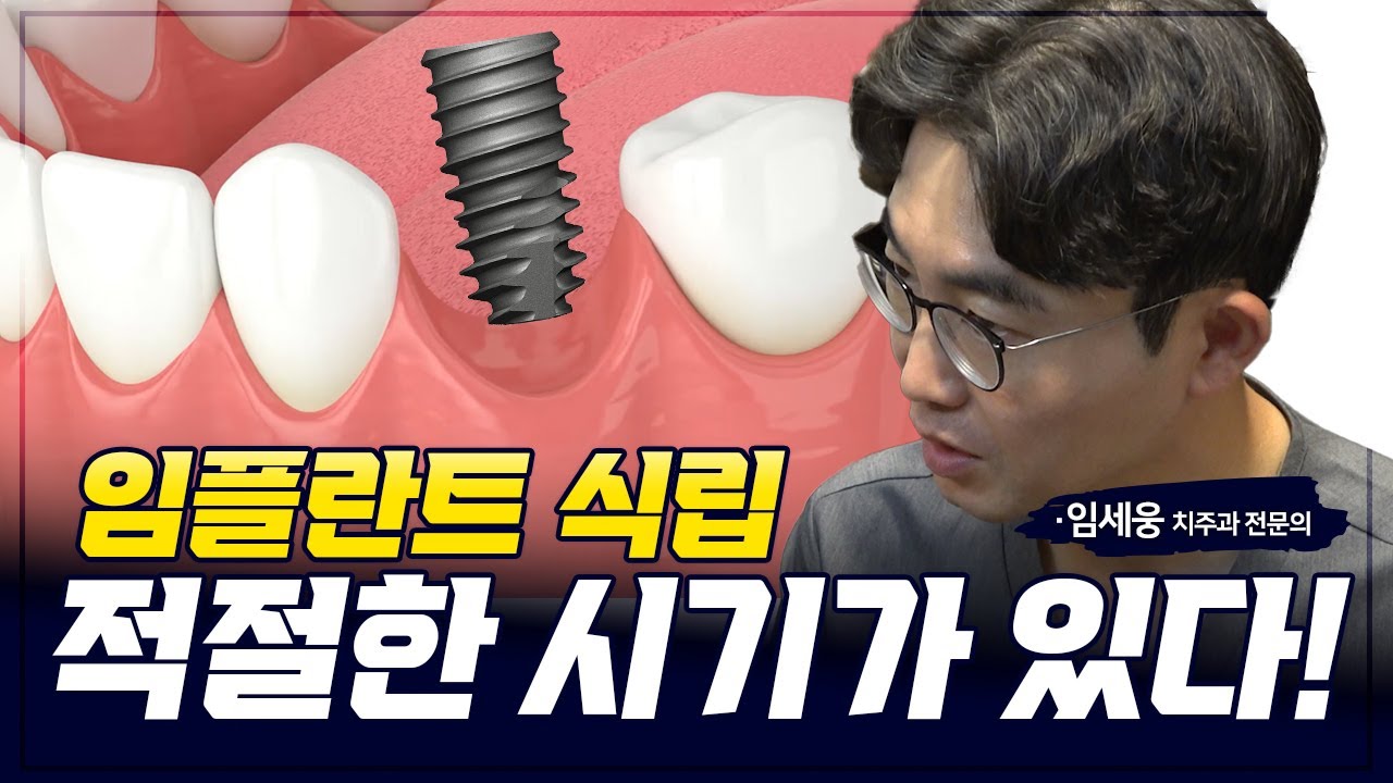 발치 후 임플란트 식립 시기 #발치 #임플란트 #식립