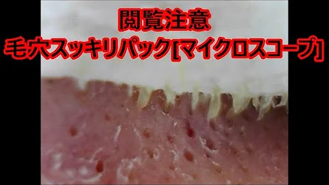 鼻 毛穴パック ごっそり Mp3