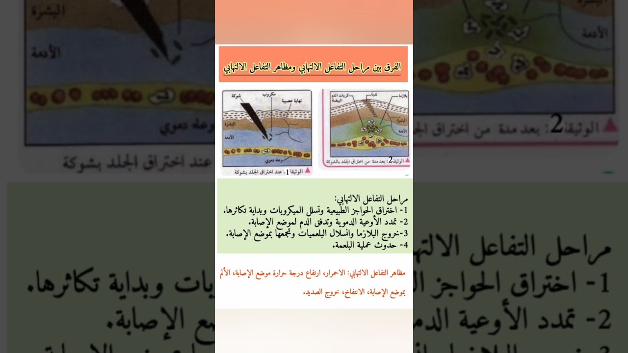 هل مراحل التفاعل الإلتهابي نفسها مظاهر التفاعل الالتهابي ؟!