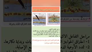هل مراحل التفاعل الإلتهابي نفسها مظاهر التفاعل الالتهابي ؟!