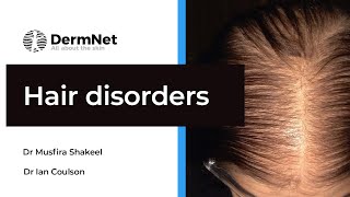 Hair Disorders: Understanding Hair Growth, Loss, and Excess