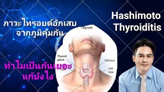 ภาวะไทรอยด์อักเสบจากภูมิคุ้มกันของตัวเอง Hashimoto Thyroiditis