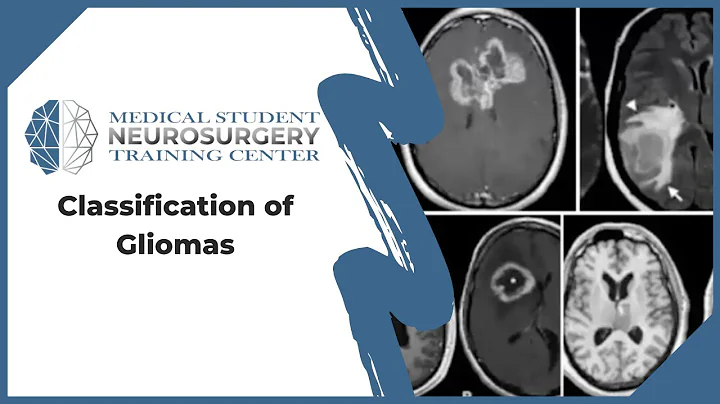 Classification of Gliomas