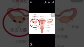 Doctor Chatbot Demonstration screenshot 5