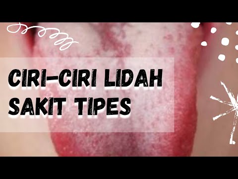 Lidah Orang Types