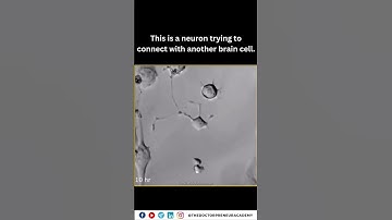"Watch a Neuron Connect and Grow: The Fascinating Journey of Brain Synapses 🌟🧠 #scienceexplained