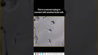 "Watch a Neuron Connect and Grow: The Fascinating Journey of Brain Synapses 🌟🧠 #scienceexplained