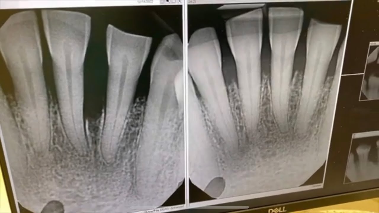 This is Your Sign 🛑 Make a Dentist 😁 Appointment ASAP!🛑 YouTube