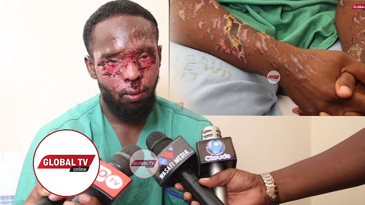 SIMANZI: KIJANA TARIQ ALIYEMWAGIWA 'TINDIKALI' ASIMULIA SIKU YA TUKIO ILIVYOKUWA - "MHUSIKA NAMJUA"