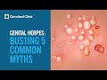 Busting 5 myths about genital herpes