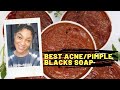 Use this to get rid of pimples / How to mix pimple black soap to get flawless skin with recipe