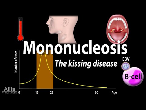 Infectious Mononucleosis - The Kissing Disease, Animation