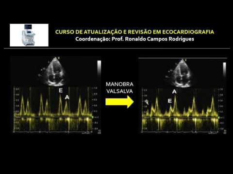 Vídeo: Análise Da Deformação Miocárdica Regional Por Ecocardiografia Com Rastreamento Speckle 2D: Validação Com Sonomicrometria E Correlação Com O Fluxo Sanguíneo Regional Na Presença De