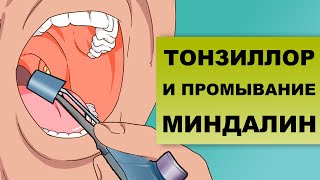 видео: ПРОМЫВАНИЕ МИНДАЛИН ТОНЗИЛЛОРОМ: особенности процедуры картинка: ПРОМЫВАНИЕ МИНДАЛИН ТОНЗИЛЛОРОМ: особенности процедуры