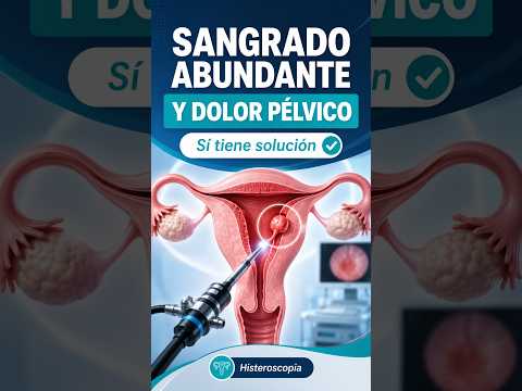 Sangrado abundante y dolor pélvico: solución con histeroscopia #Histeroscopia #Ginecología