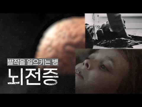 발작을 일으키는 병 🩺 뇌전증ㅣ소아뇌전증