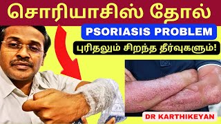 சொரியாசிஸ் உணவு முறைகள்? psoriasis skin disease treatment diet | dr karthikeyan tamil
