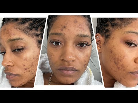 Keke Palmer Goes