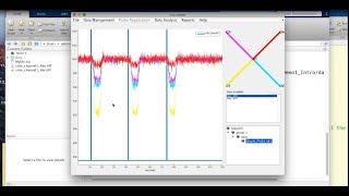 Advanced NIRS Analysis Course 2018 - Toolbox: GUIs
