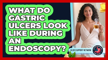 What Do Gastric Ulcers Look Like During An Endoscopy? - Ulcer Support Network