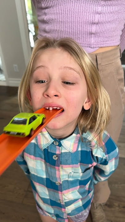 Car knocks out tooth! 😭🦷