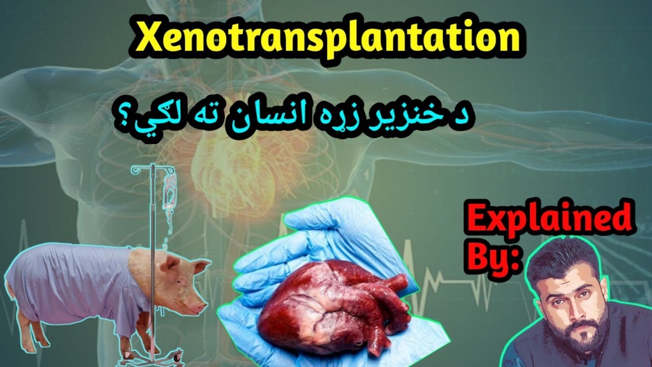 Xenotransplantation Pig Heart to Human Body Tariq Pathan YouTube