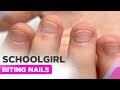 Extremely Bitten Nails | Manicure for a Schoolgirl