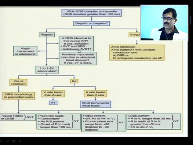 Wide QRS Tachycardia - Dr.Yusuf A Kumble  27.09.2013 07 class=