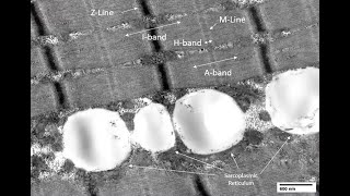 Webinar: Preparation of Cells & Tissue for Clinical Diagnostics TEM