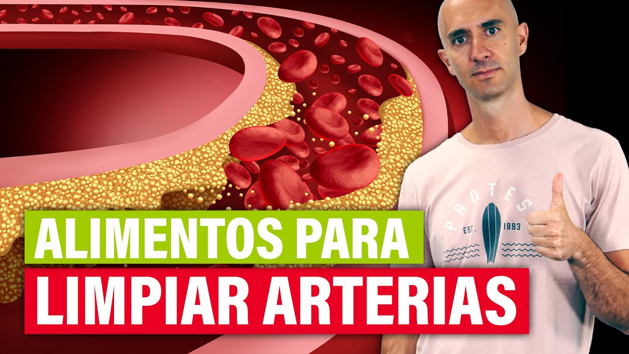 7 alimentos que limpian las arterias ¿Cómo limpiar tus arterias?