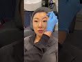 ✨Tip Tuesday with Nurse Dra✨ Botox touch ups are normal! #botox #skincare #medspa #houstonmedspa