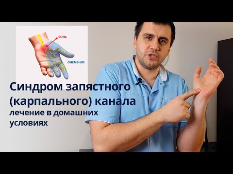 Синдром запястного (карпального) канала лечение в домашних условиях