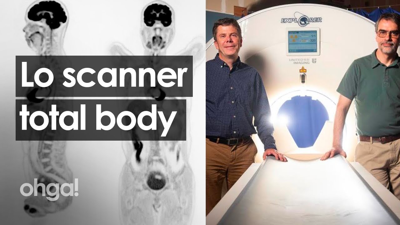 Explorer, lo scanner total body rivoluzionario è il più preciso al mondo nella diagnosi dei tumori