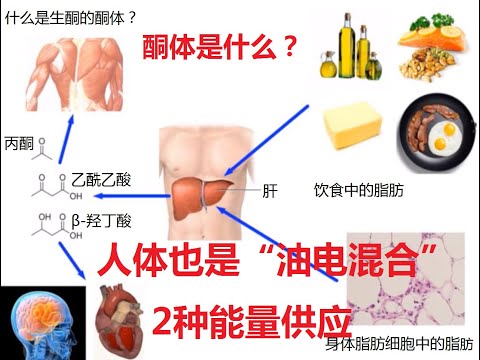 生酮的酮体是什么组成？来自哪里？大脑的葡萄糖来源与后备能量