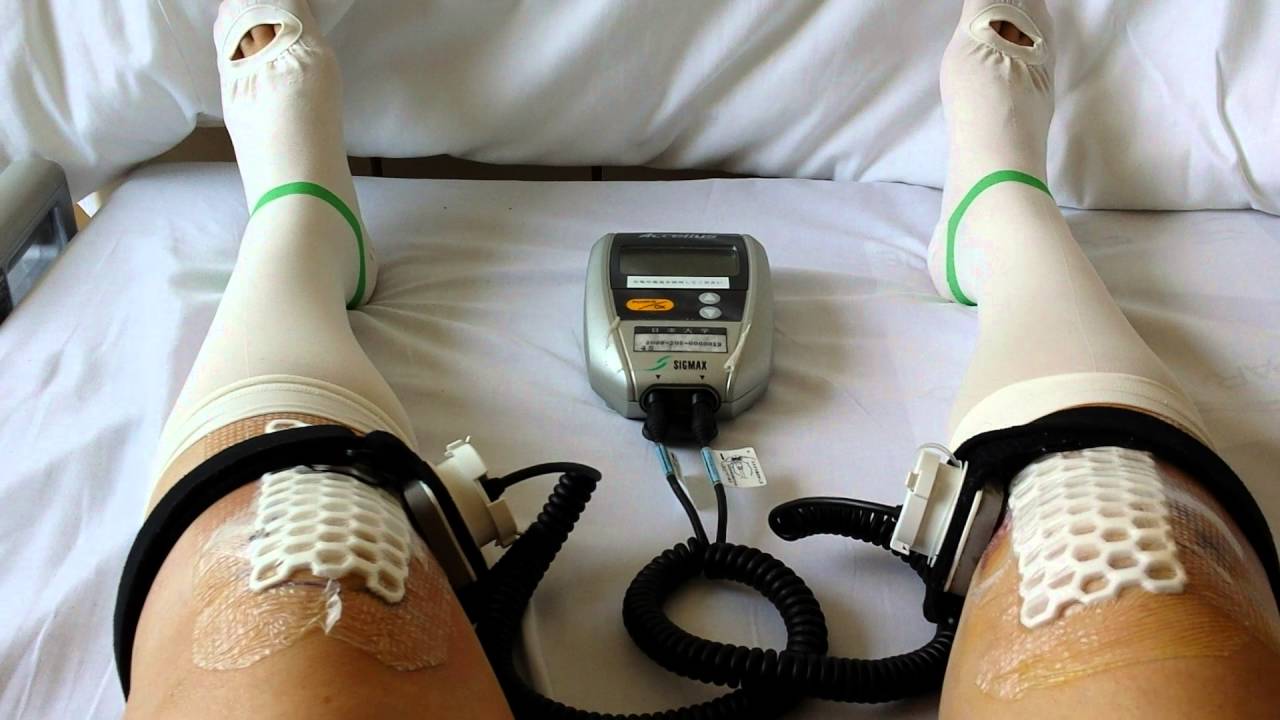 入院 高位脛骨骨切り術 変形性膝関節症 術後4日目 骨折 超音波治療器 スポーツ選手など Youtube