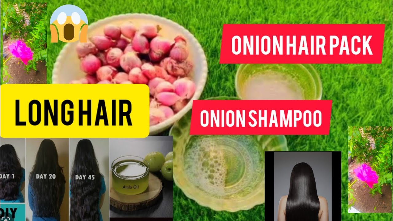 My hairTransformation inweek😱சரியான💯தீர்வுExtremehairgrowth 🤯/onionjuice/onion hair pack