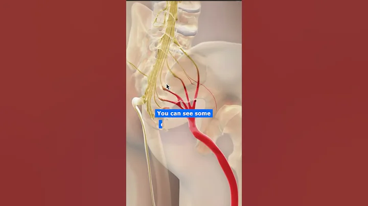 Is SI Joint the reason for your sciatica ?!