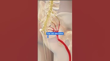Is SI Joint the reason for your sciatica ?!