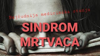 Sindrom ZOMBIJA !!! Čudna medicinska stanja