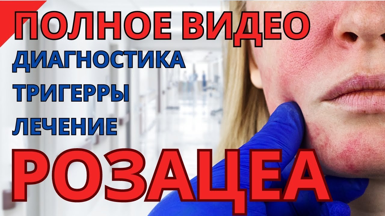 Что такое розацеа и как от неё избавиться