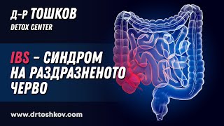 Д-р Тошков за IBS - Синдром на раздразненото черво