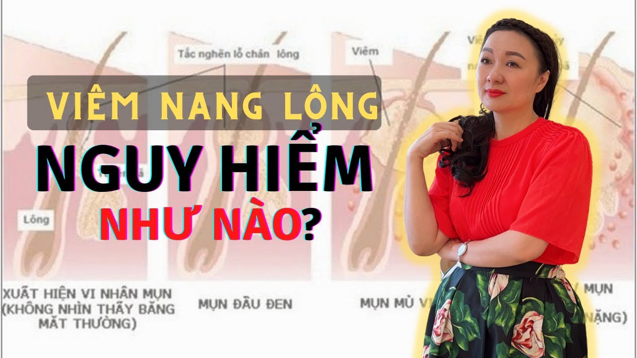 Bí quyết điều trị viêm nang lông và các nguyên nhân... - youtube