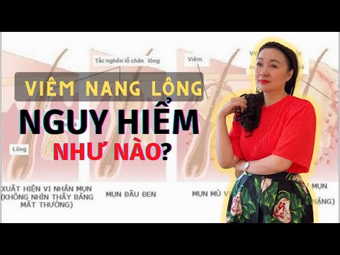 Video Bí quyết điều trị viêm nang lông và các nguyên nhân... - youtube