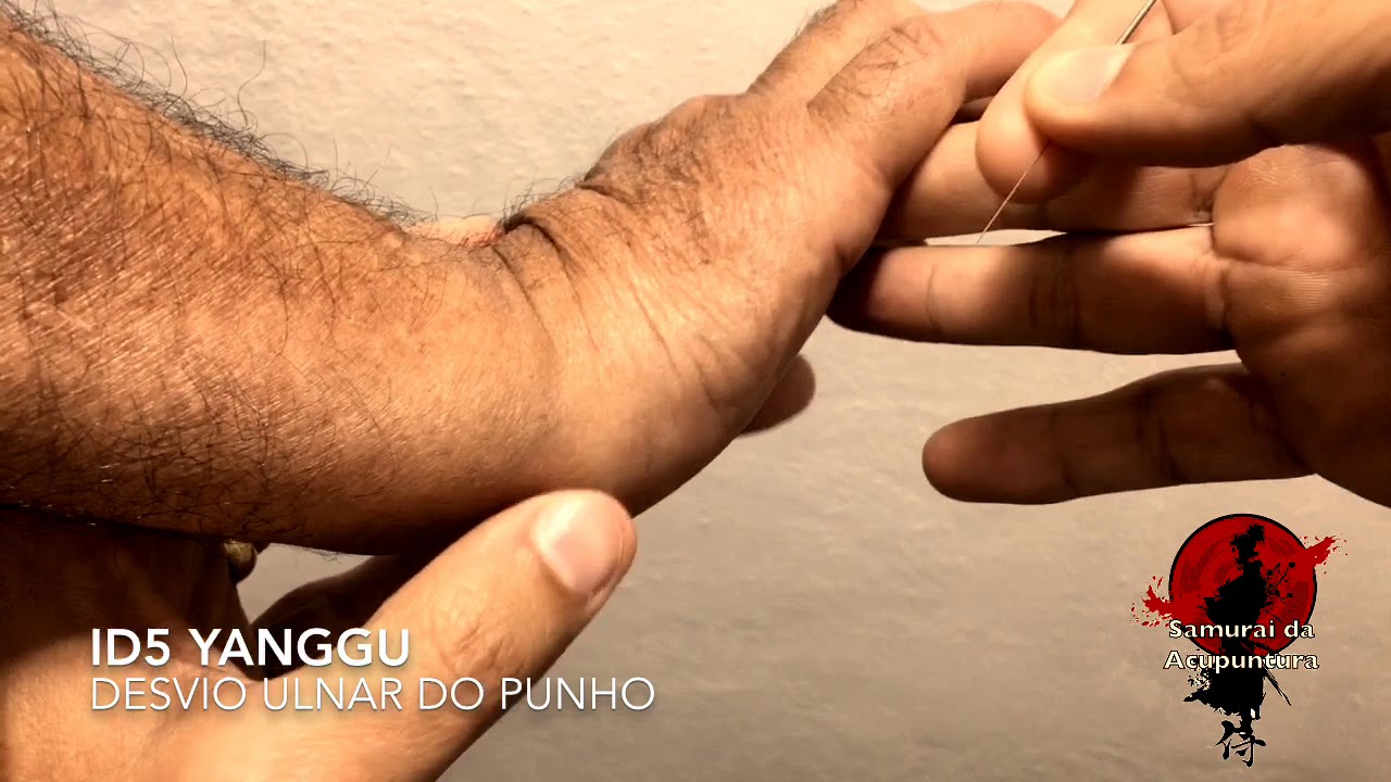 ID5 - Yanggu aed to peso