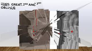 Radiographic Lower Extremity Positioning