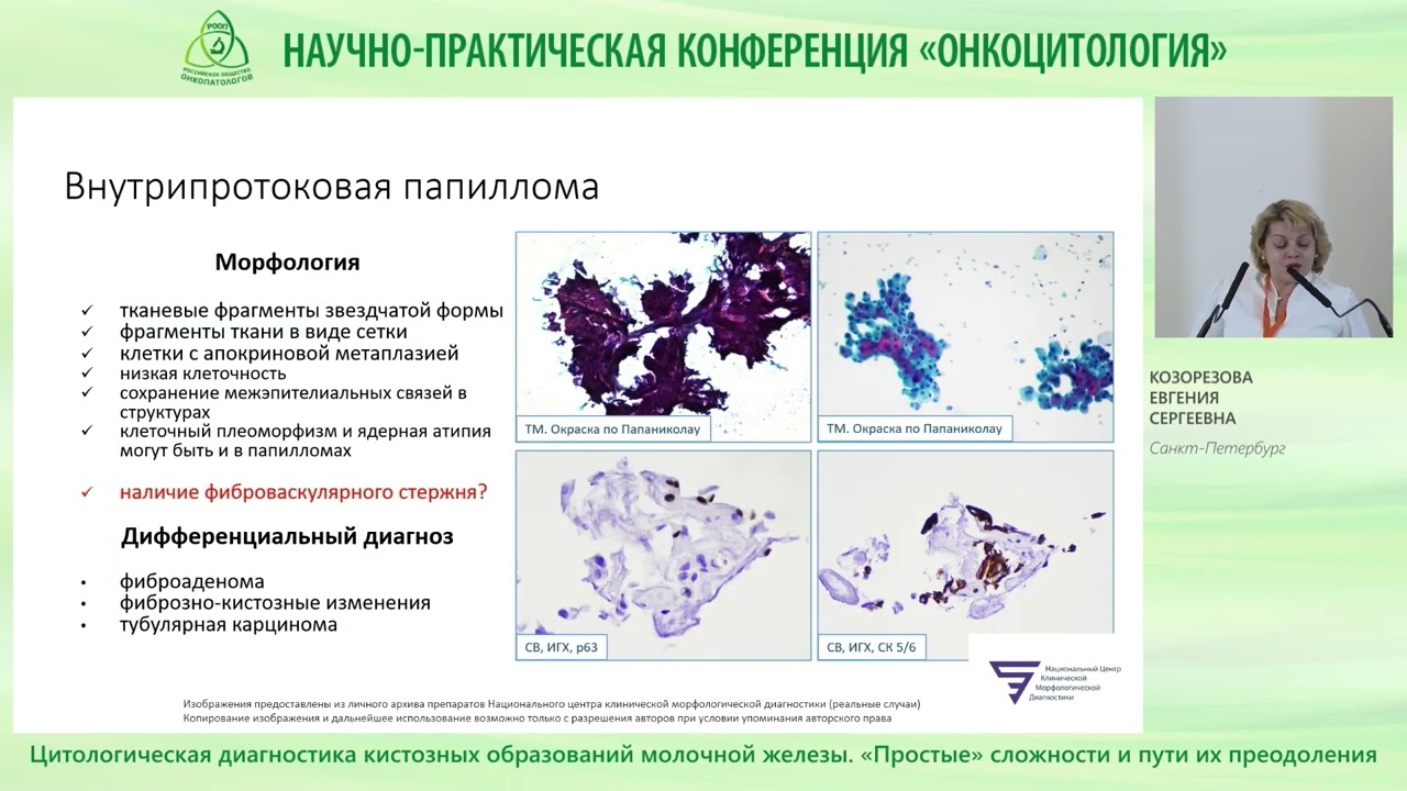 Цитологическая диагностика кистозных образований молочной железы