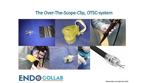 Over-The-Scope-Clip (OTSC): A One Minute Tutorial On It