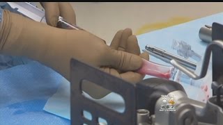 Famous I-Team: New Warning About Stem Cell Therapies Wealth